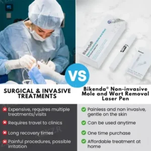 Bikenda® Non-Invasive Mole and Wart Removal Laser Pen