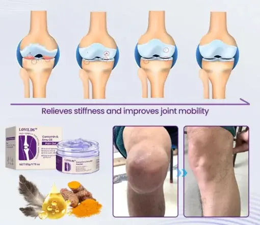 LOVILDS™ Curcumin & Emu Oil Pain Gel