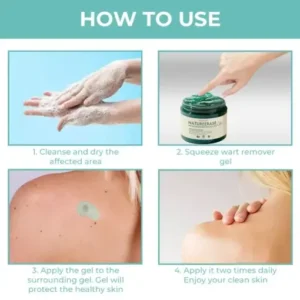 LOVILDS™ NatureErase Instant Mole & Spot Removal Gel