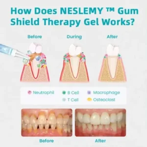 NESLEMY™ Gum Shield Therapy Gel 2025