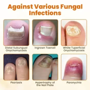 Timilk® FungiBee Advanced Nail Repair Spray