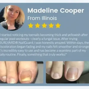 Ourlyard® NailGuard Fungal Repair Herbal Spray