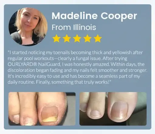 Ourlyard® NailGuard Fungal Repair Herbal Spray