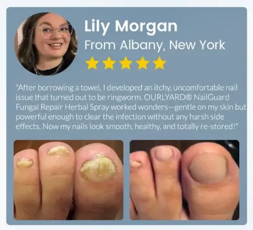 Ourlyard® NailGuard Fungal Repair Herbal Spray