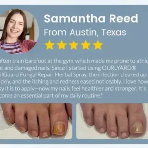 Ourlyard® NailGuard Fungal Repair Herbal Spray