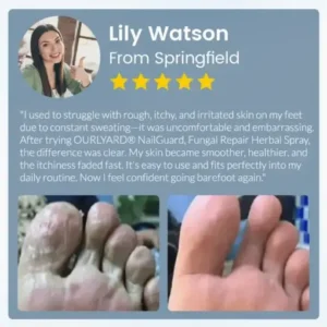 Ourlyard® NailGuard Fungal Repair Herbal Spray