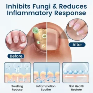 Ourlyard® NailGuard Fungal Repair Herbal Spray