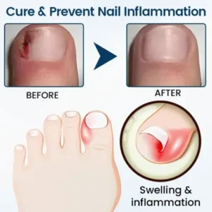 Ourlyard® NailGuard Fungal Repair Herbal Spray