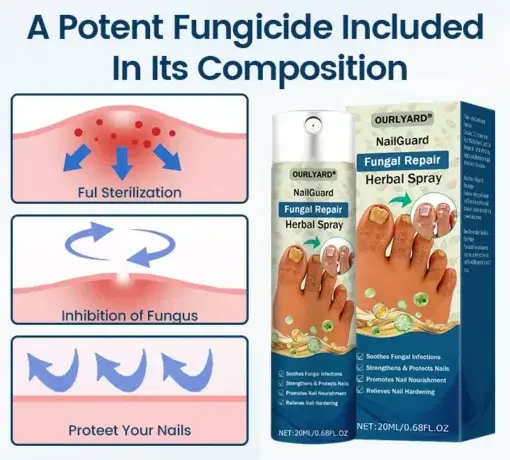 Ourlyard® NailGuard Fungal Repair Herbal Spray