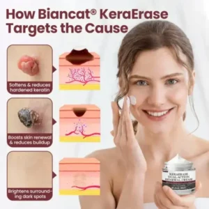 Biancat® KeraErase Dual-Action Renewal Cream